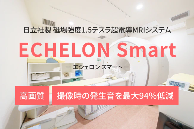 － エシェロン スマート －